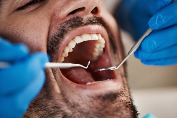 Best Emergency Tooth Extraction  in Oglala, SD