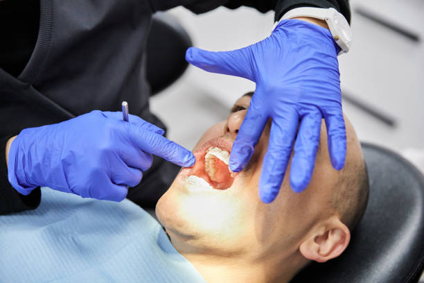 Best Dentist for Dental Trauma  in Oglala, SD