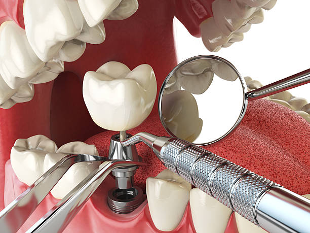 Best Urgent Tooth Repair  in Oglala, SD